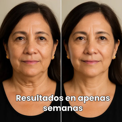 Skinlift™ Elimina papada y flacidez en minutos